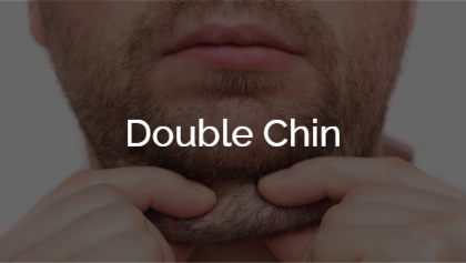 Double Chin