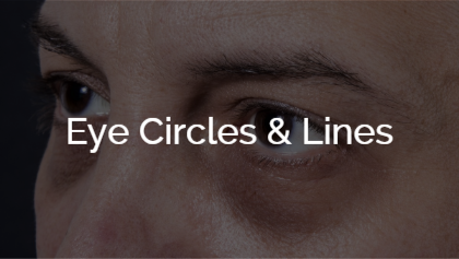 Eye Circles & Lines