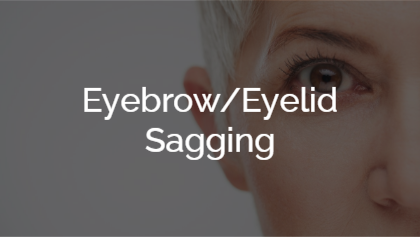 Eyebrow/Eyelid Sagging