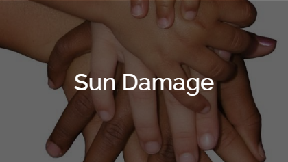 Sun Damage