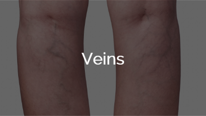 Veins