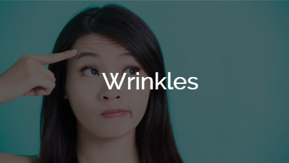 Wrinkles