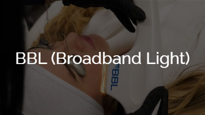 BBL (Broadband Light)